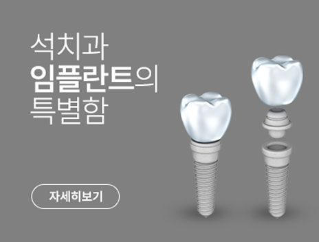 디지털 임플란트